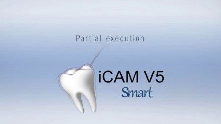 iCAM V5 smart ReFit Integrați geometriile definite de client
